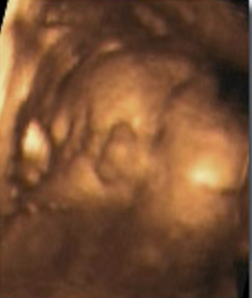 Hafta hafta bebeğin ultrason görüntüleri-34.hafta