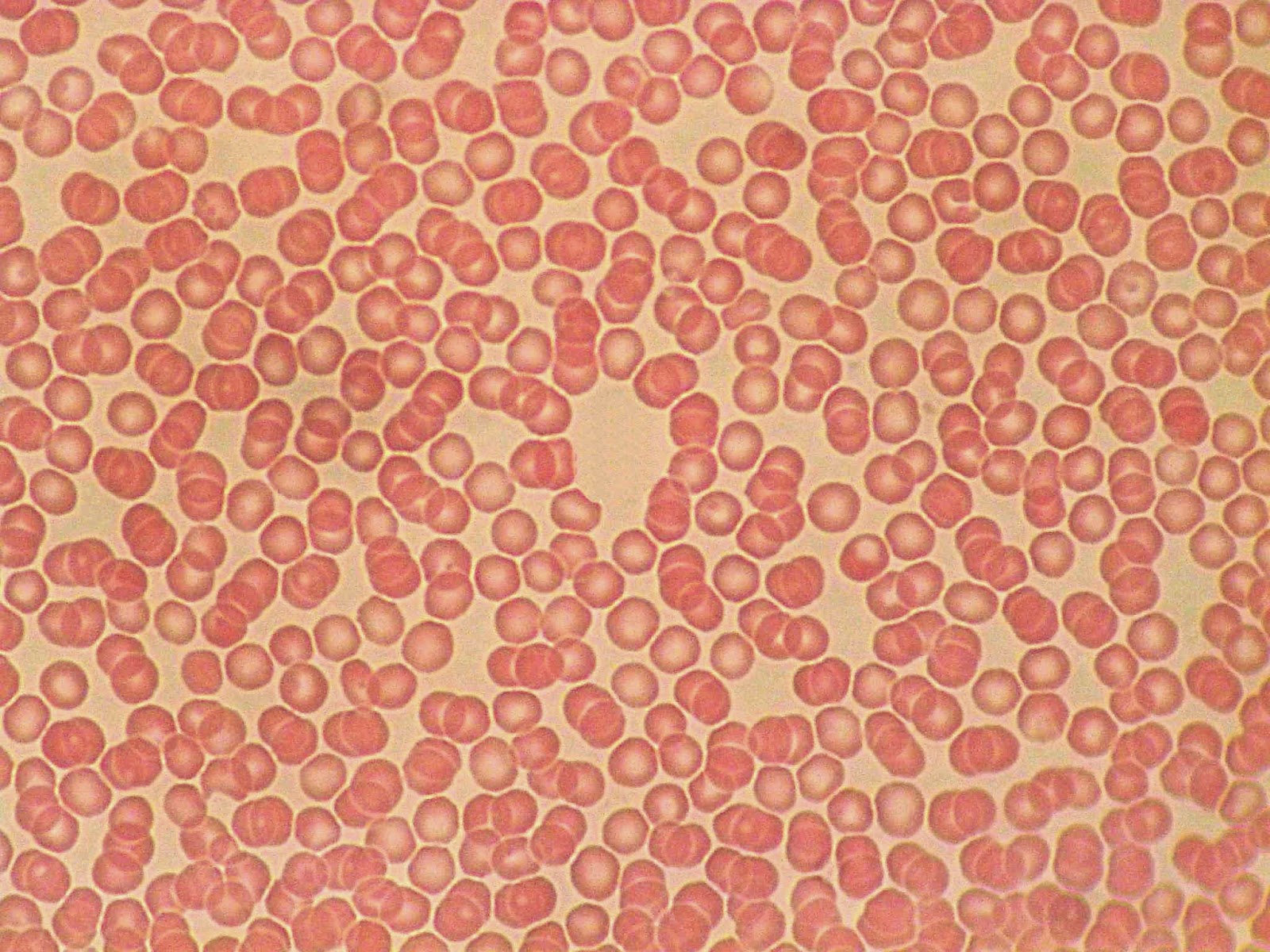 CUADERNO DE PR CTICAS HEMATOLOG A Pr ctica Preparaci n De Sangre En cuaderno-de-pr-cticas-hematolog-a-pr-ctica-preparaci-n-de-sangre-en