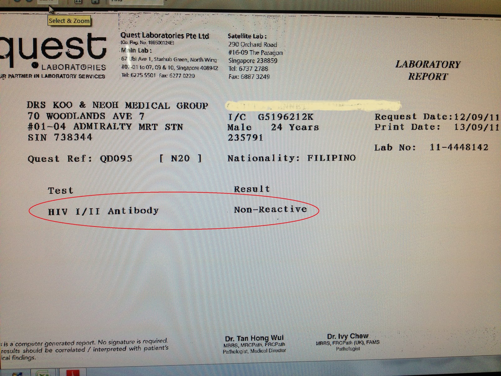 astroboi private limited World AIDS Day