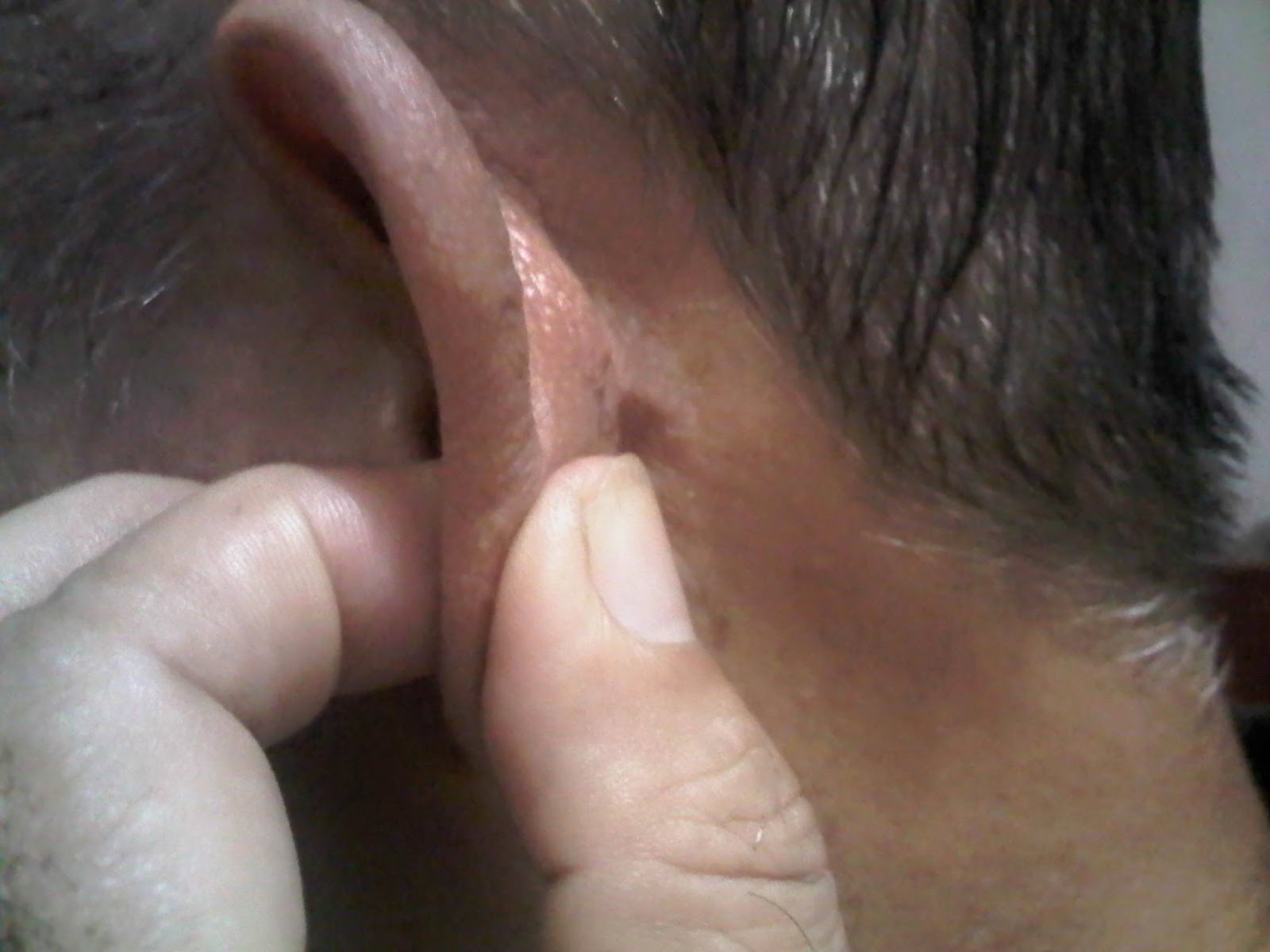 Tentang Apa Saja Vertigo