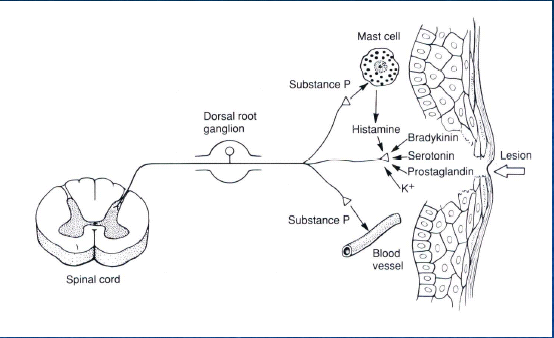 Hiperalgesia primaria