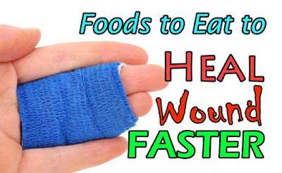 High Protein-based foods that help for healing wounds faster!