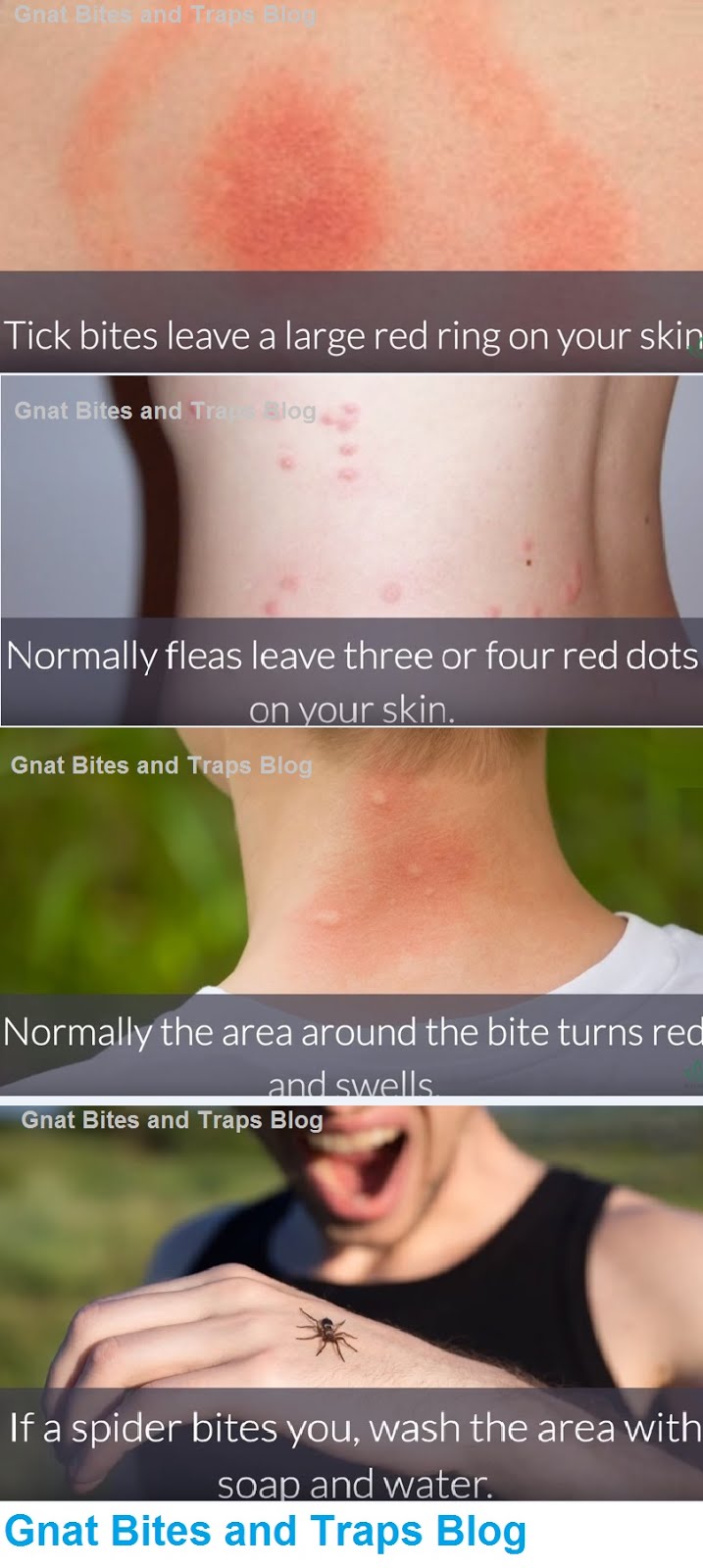 What Bit Me? How to Identify Common Bug Bites? with photos Best