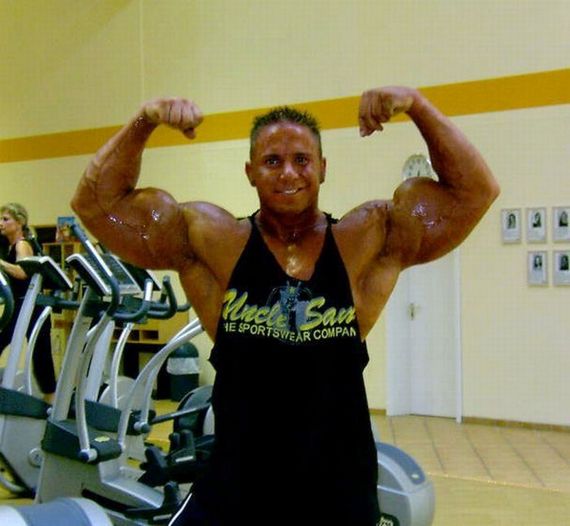 Daily Bodybuilding Motivation Synthol Arms