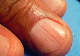 Cápsulas Asi Sucede: Tus uñas reflejan que tan saludable estás.
