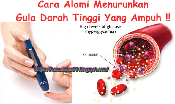 Gula kadar waktu menurunkan Cara Cepat Menurunkan Gula Darah : Cara Menurunkan Kadar Gula Darah