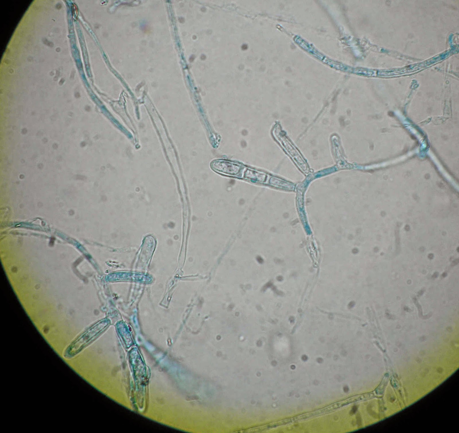 Epidermophyton floccosum