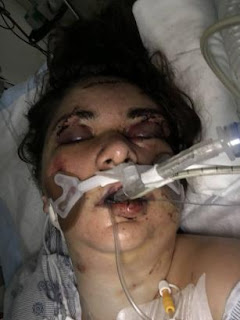 Graphic: Woman nearly beaten to death by a roommate she found on Craiglist - Campus Trybe