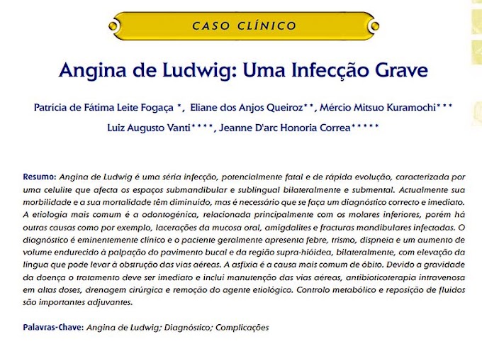 PDF: Angina de Ludwig: Uma Infecção Grave