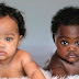Twin babies with different skin colours have become Instagram stars 