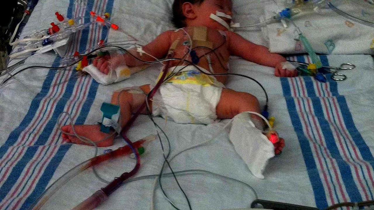 Pediatric Heart Surgery - Hear Choices