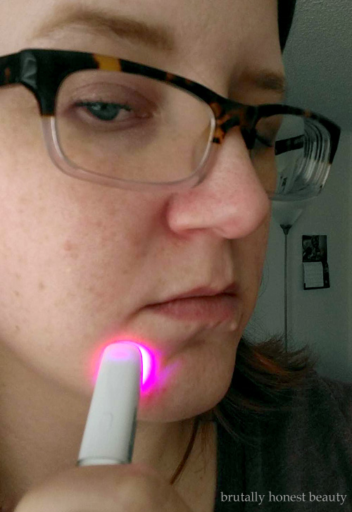 velgørenhed Mart Krudt brutally honest beauty: Cures without Creams: Review of Neutrogena Light  Therapy Acne Spot Treatment Pen