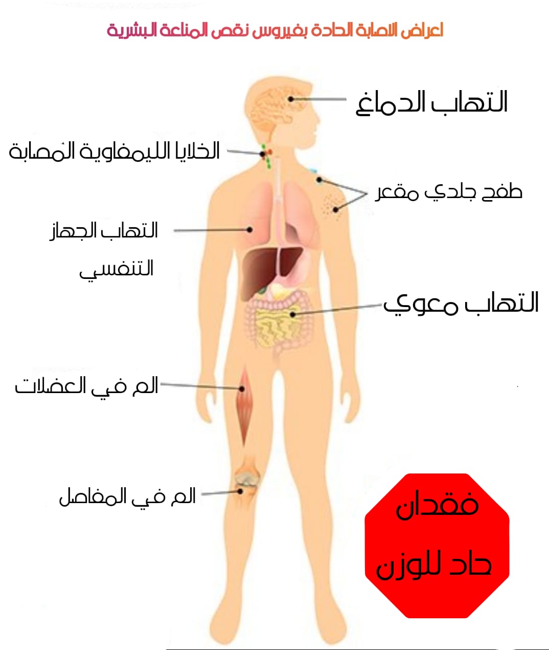 متى تظهر أعراض الإيدز