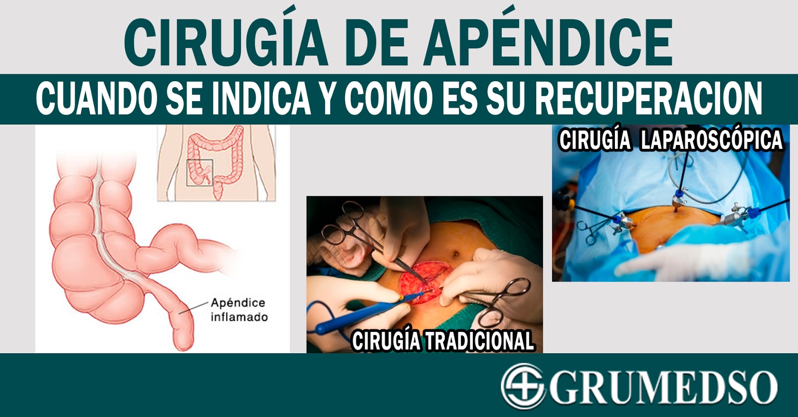CLINICA GRUMEDSO CIRUGIA DE APENDICE