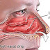 DIY: How To Clear Your Sinuses in Seconds Using Nothing but Your Fingers