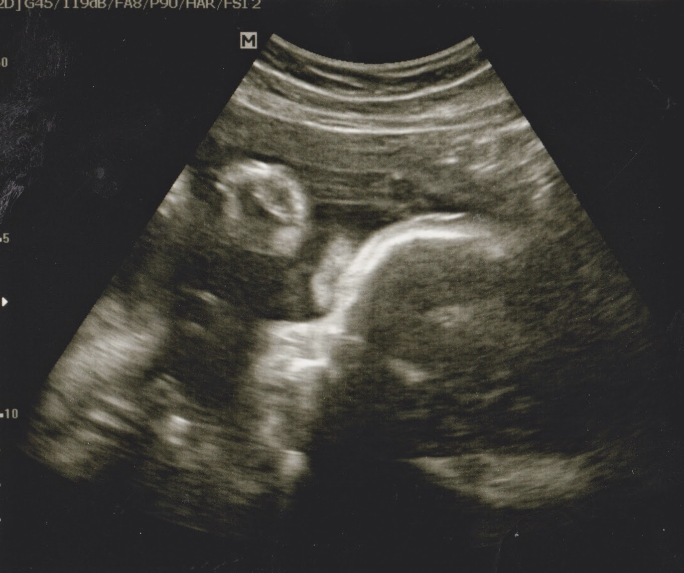 The Journey of Parenthood... 32 Weeks Pregnant and Last Ultrasound Visit!