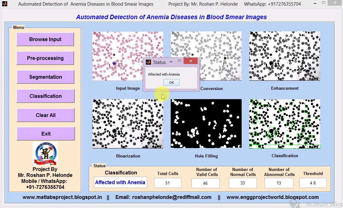 Matlab Code for Anemia Diseases Detection in Blood Cells Smear Using