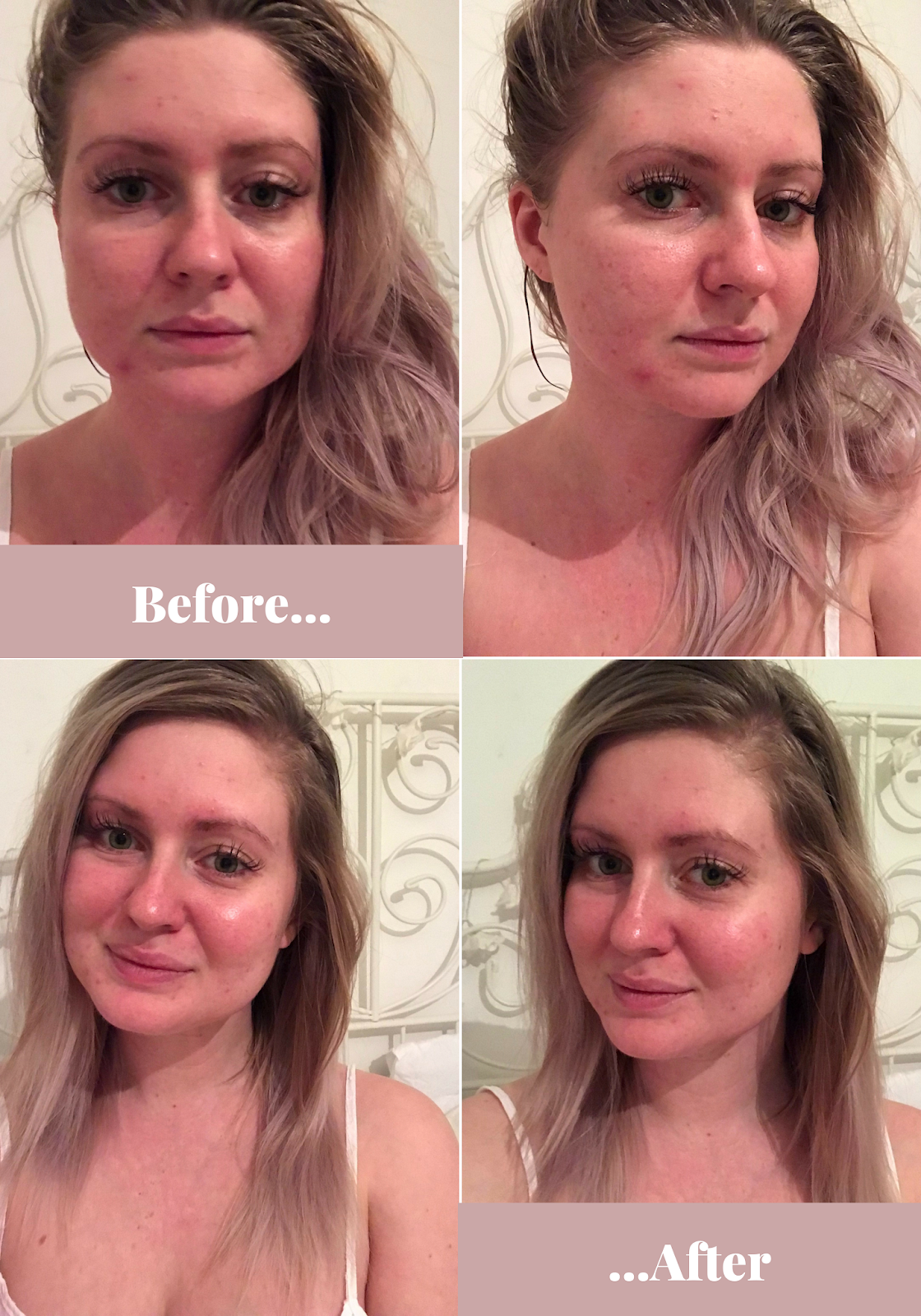 The Skin Coach Review | Hampshire blogger