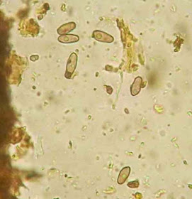 Catinella olivacea ascospores look like tiny feet.