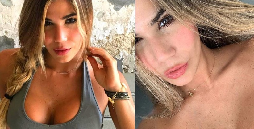 Καλλονή δημοσιεύει φωτογραφίες από το κακοποιημένο σώμα της Καλλονή δημοσιεύει φωτογραφίες από το κακοποιημένο σώμα της