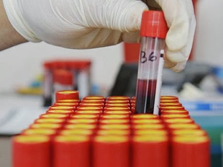 enlace de diabetes a prueba de demencia enlace de diabetes a prueba de demencia