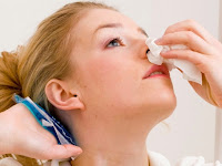 Tips Cara Benar untuk Mengatasi Hidung Mimisan