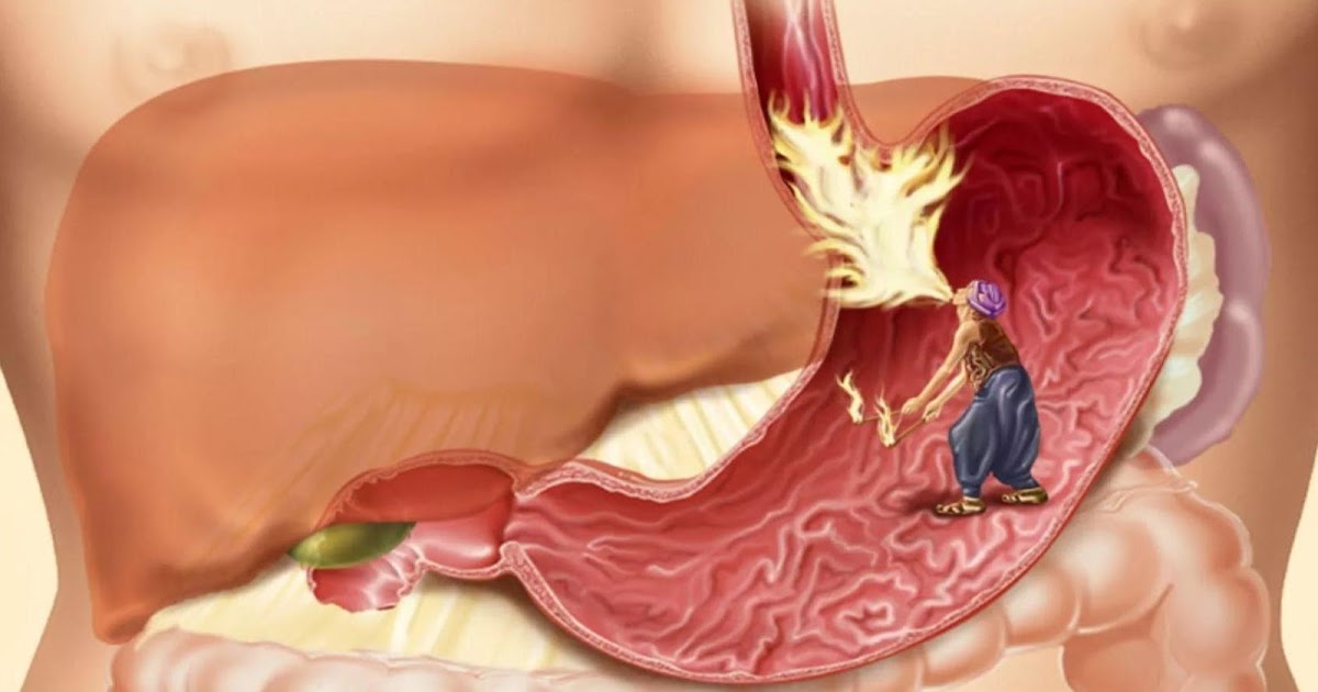 заболевания желудочно-кишечного тракта. боли в животе при дискинезии на картинке. спазм желудка при гастрите. спастические сокращения пищевода. летние проблемы с жкт.