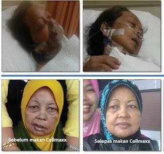 Testimoni CellMaxx Testimoni CellMaxx, Kesaksian cellmaxx, cellmaxx untuk stroke, cellmaxx testimoni stroke