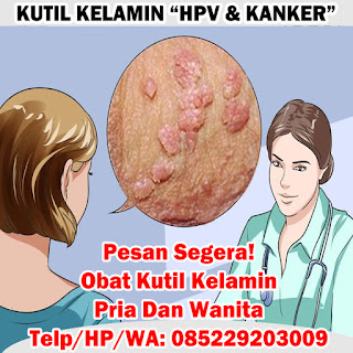 Obat Kutil Kelamin