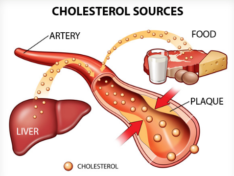 Perbedaan Kolesterol dengan Lemak