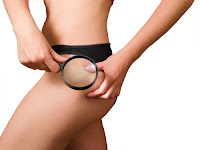 eliminar la celulitis, como eliminar la celulitis, como eliminar celulitis