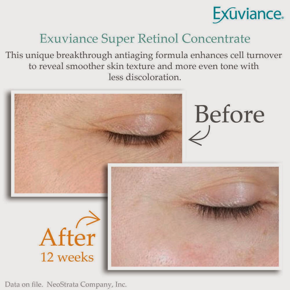 Giveaway #SleepOnIt Exuviance Retinol Concentrate