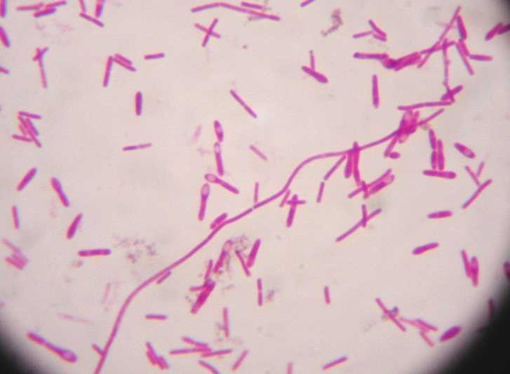 Anthrax (Bacillus Anthracis) - sfcdcp.org