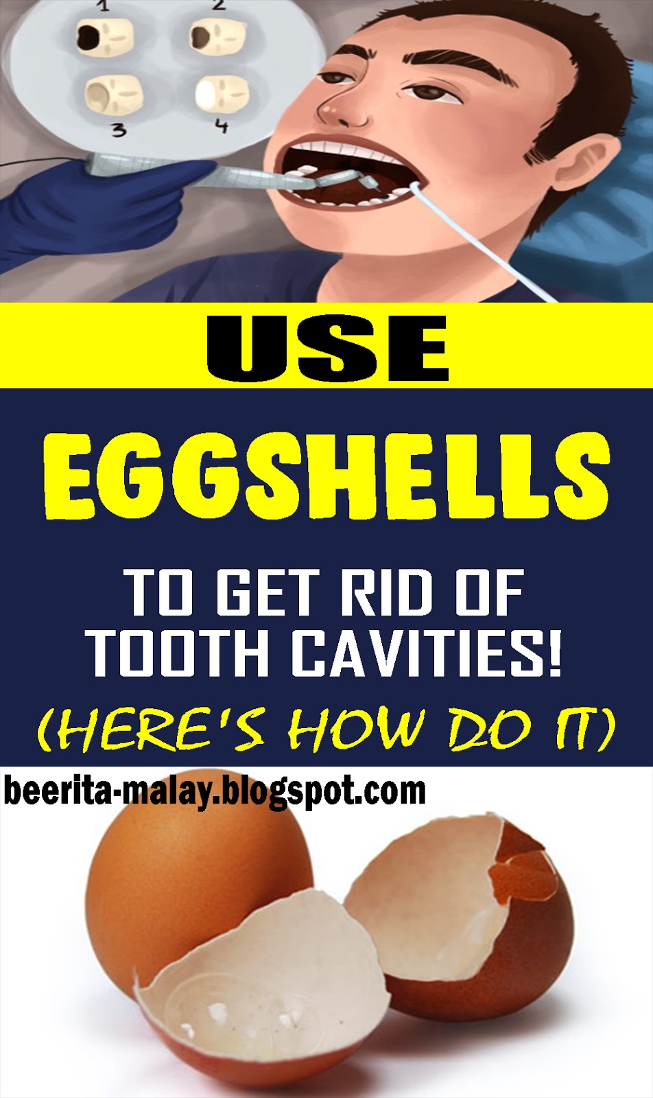 USE EGGSHELLS TO GET RID OF TOOTH CAVITIES! HERE’S HOW TO DO IT