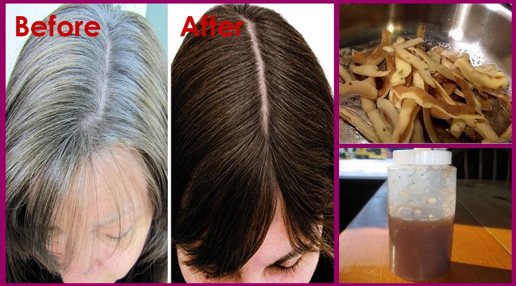 A Natural Remedy To Give Your White Hair Their Original Color