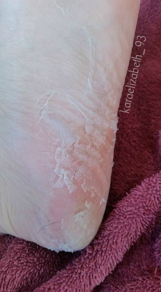 Kara Elizabeth Beauty Perfectly Posh Foot Peel Kit Review