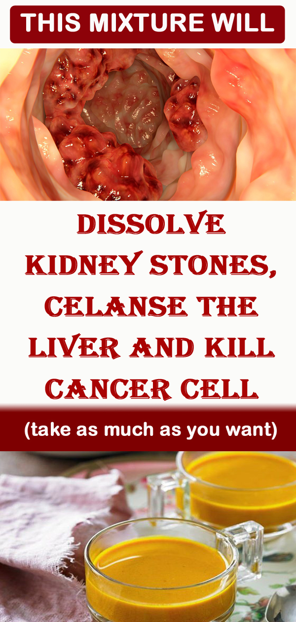 Ginger Tea Recipe To Dissolve Kidney Stones, Cleanse Liver And Kill