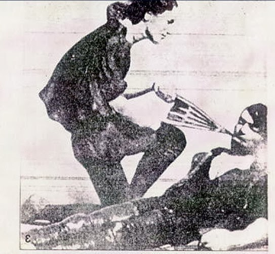 Asthma History 17741829 Humane Society used intubation, bellows