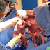 Video: Gemelas nacieron agarradas de la mano en EEUU