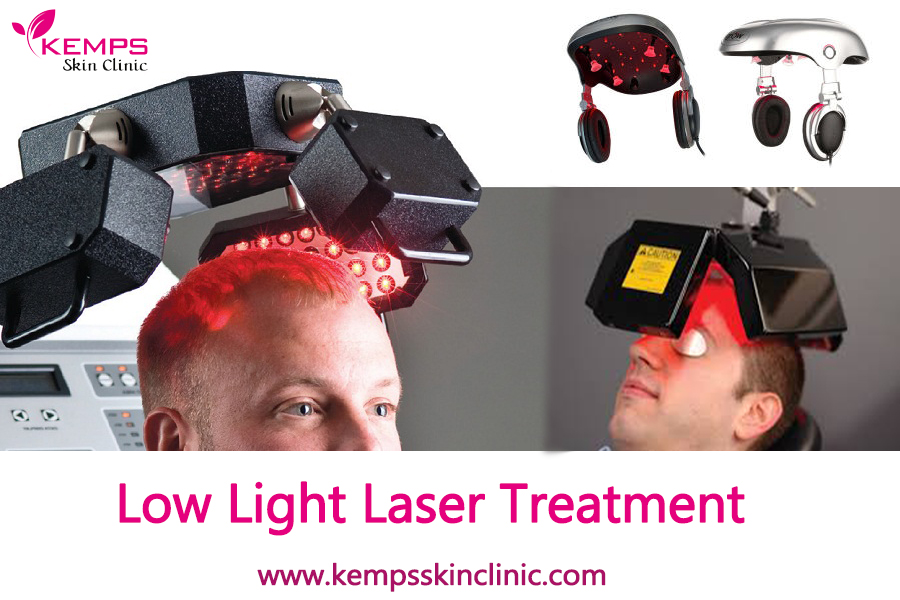 How does the low level light laser therapy work in hair loss? KEMPS