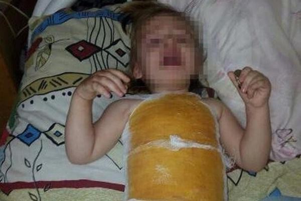 В Баймакском районе произошёл трагический случай: от ожогов погиб двухлетний ребёнок В Баймакском районе произошёл трагический случай: от ожогов погиб двухлетний ребёнок
