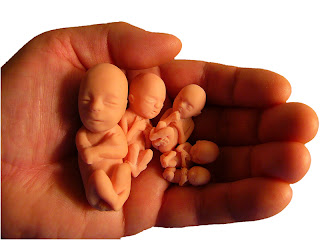 Aborto - Delitos contra la vida humana dependiente