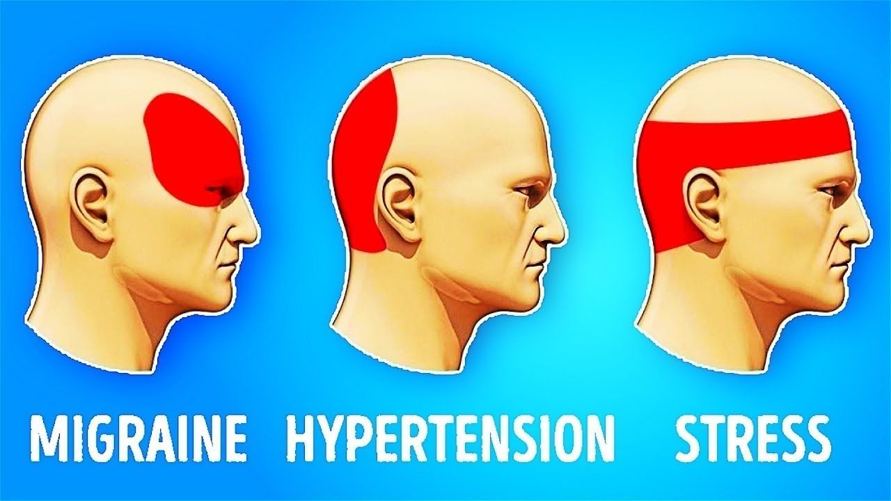 Here's How To Get Rid Of A Headache In 5 Minutes Without Pills