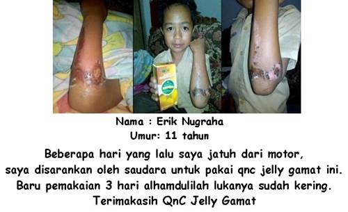 Cara Mengobati Eksim Kering Secara Alami Terbukti Mujarab ~ TESTIMONI QNC JELLY GAMAT Cara Mengobati Eksim Kering Secara Alami Terbukti Mujarab ~ TESTIMONI QNC JELLY GAMAT