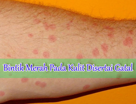 gatal bintik merah menyebar
