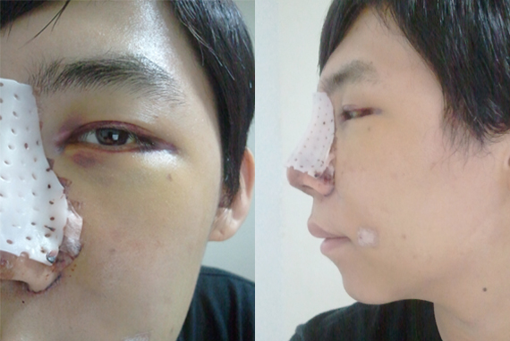 Real Diary I Want to Look Like KPOP Idol With Korean ...