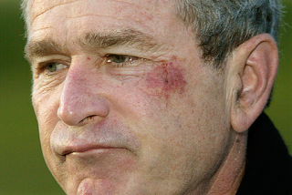 Bush after “choking on a pretzel”