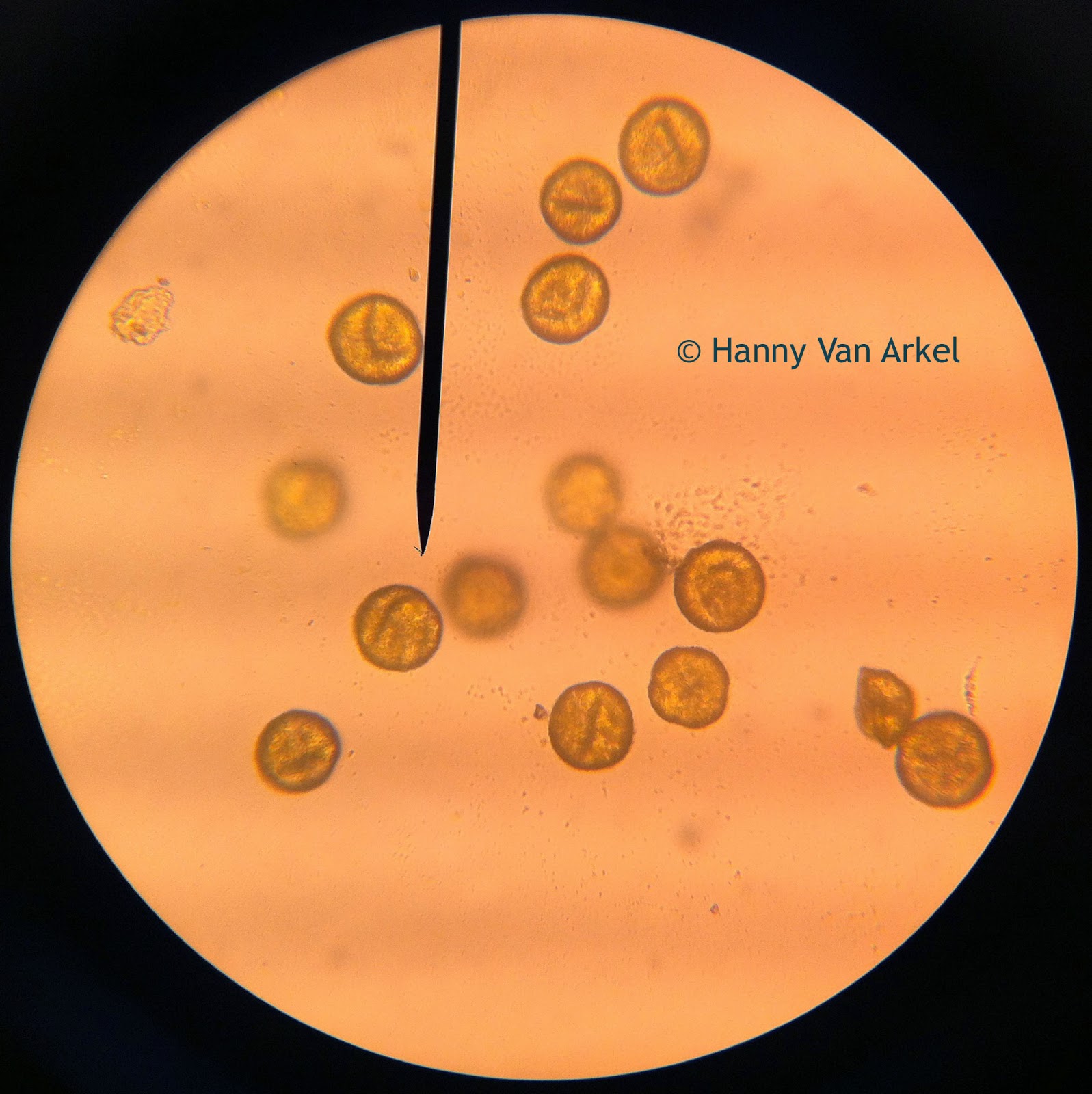 pollen microscopy image at 400x