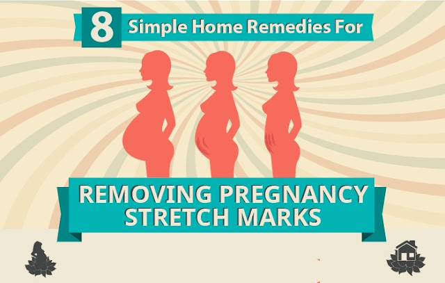 10 Simple Home Remedies For Removing Pregnancy Stretch Marks