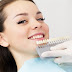 Benefits of Professional Teeth Bleaching